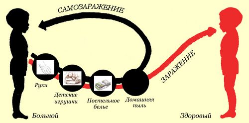 як лікувати дитячу гострики