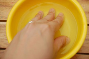 як лікувати псоріаз нігтів в домашніх умовах