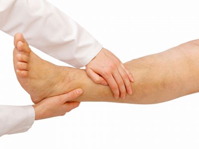 як лікувати судини ніг