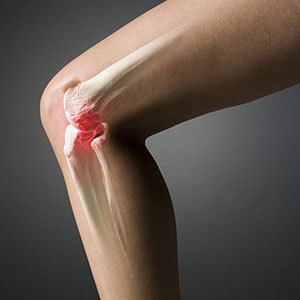 гімнастика при артрозі колінного суглоба артроз колінного суглоба методи лікування