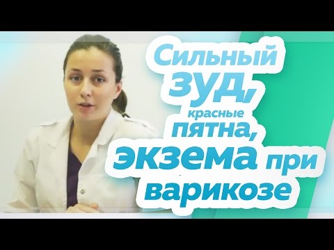 як лікувати застійний дерматит