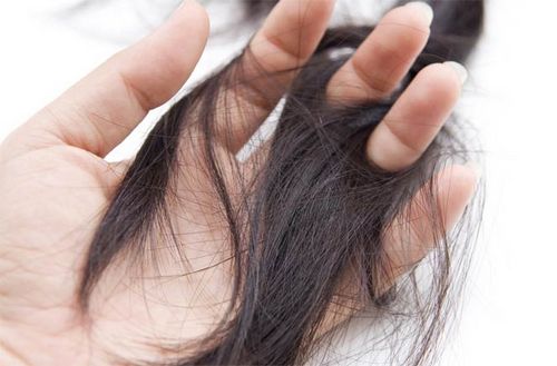 як лікувати випадання волосся після пологів