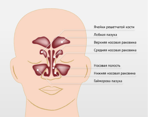 хронічний нежить заразний