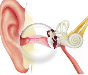 як лікують отит середнього вуха