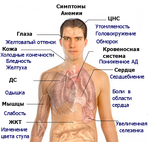 симптоми залізодефіцитної анемії