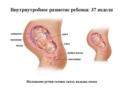 вагітність 37 тижнів узі, узі 37 тиждень вагітності аналіз обстеження стан мама як виглядає що вміє дитина висновок узі 37 тиждень вагітності аналіз обстеження стан мама як виглядає що вміє дитина висновок