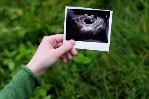 4 тиждень вагітності узі, узі 4 тиждень вагітність фото узі 4 тиждень вагітність фото