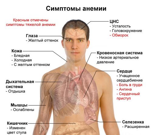 як лікувати анемію у дорослих