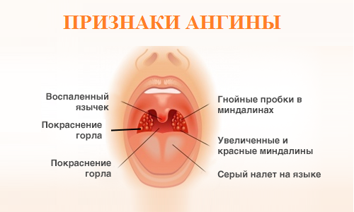 як лікувати температуру в однорічної дитини