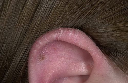 як лікувати вуха у людини