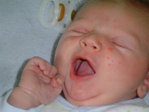 як лікувати дитину 8 місяців від кашлю