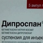 лікувати деформуючий артроз колінних суглобів