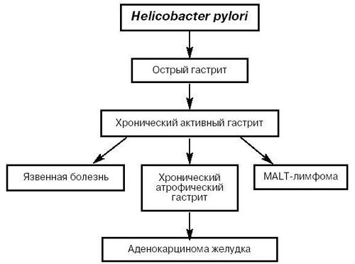 лікування