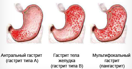 симптоми