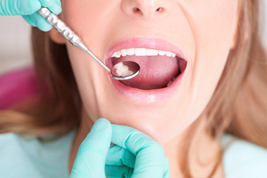лікування карієсу зубів