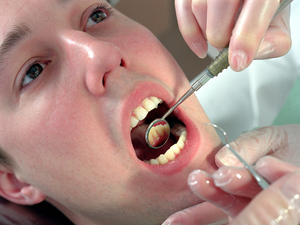 як лікувати кісту зуба