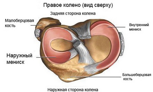 Як лікувати меніск - консервативно або оперативно? як лікувати внутрішній меніск