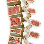 який лікар лікує остеопороз звертатися якого хребет кісток фахівець лікуючий доктор як називається