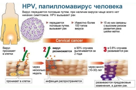 у кого лікувати папіломи