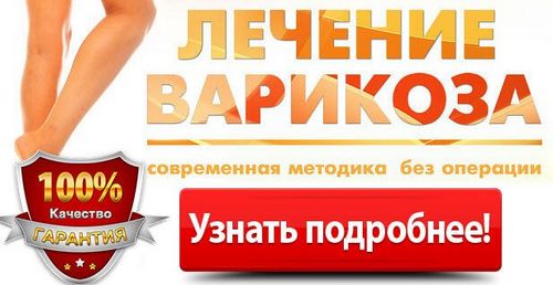 кінський каштан від варикозу лікувальні властивості і протипоказання