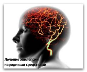 Лікування епілепсії народними засобами: ефективно чи ні? вилікувати епілепсію народними методами
