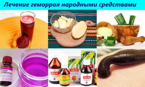 як лікувати легкий геморой