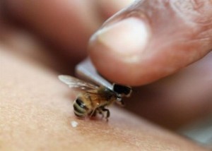 як лікувати варикоз бджолиною отрутою