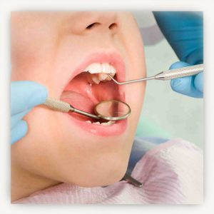 лікувати зуби дитині 3 роки