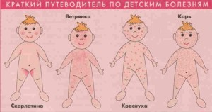 Від чого з'являється і як лікується вірусний (інфекційний) дерматит? як лікувати інфекційний дерматит