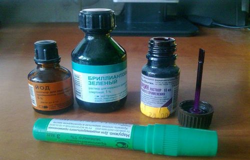 Отит середнього вуха симптоми і лікування в домашніх умовах як лікувати отит у дитини в домашніх умовах
