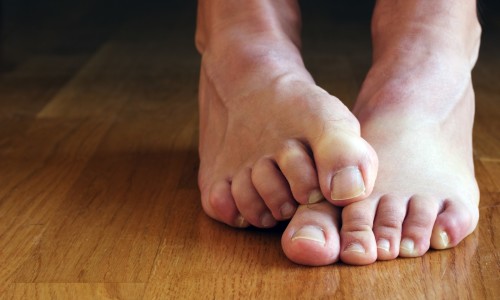 як вилікувати ноги від болячок