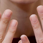 як лікувати жовті нігті на руках