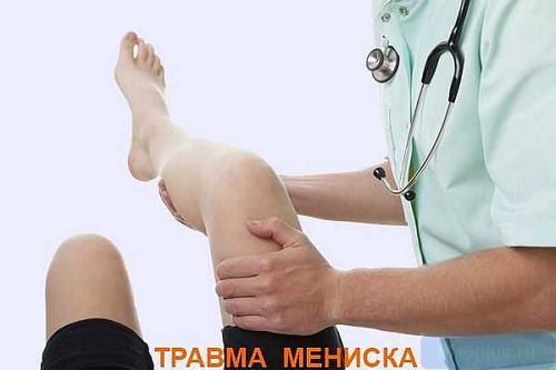 Пошкодження меніска: діагностика та лікування травми хрящ