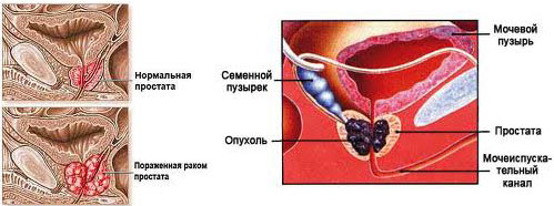 харчування