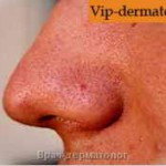 як лікувати стрептодермії у носі