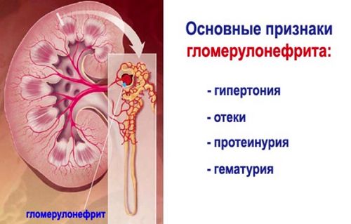 чи можна лікувати нирки під час вагітності