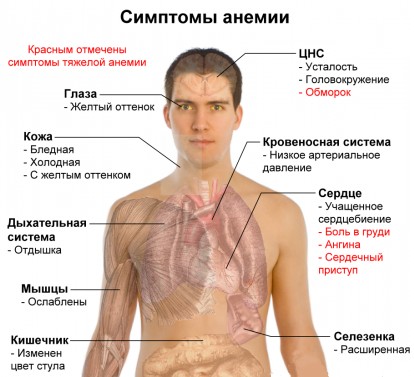 як лікувати залізодефіцитну анемію народними засобами