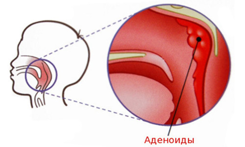 здорове горло