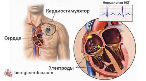 лікування