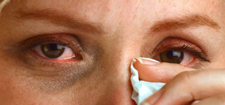 демодекс очі повіки вії симптоми лікування