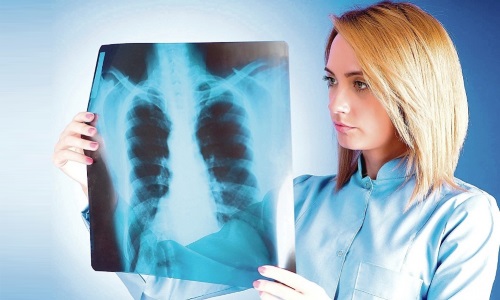 як лікувати розпад легенів