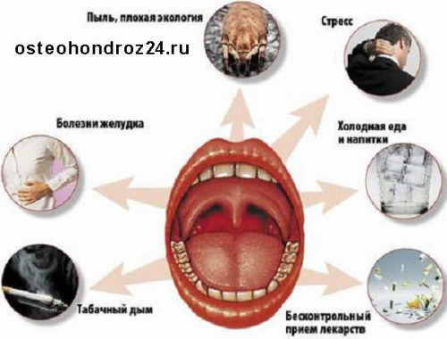 як лікувати гострий фарингіт у дорослих