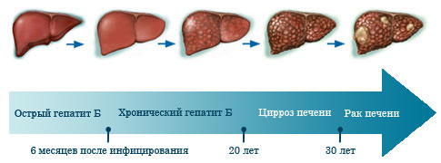 гепатит б ефективність лікування