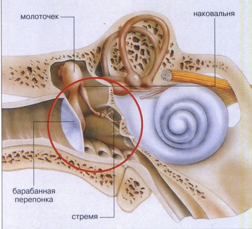 лікувати середній отит