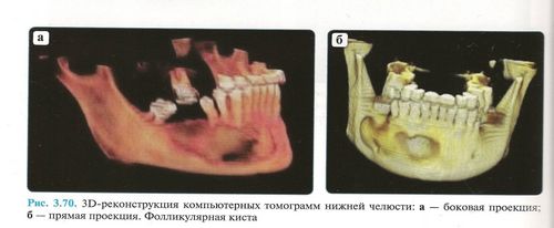 лікуємо зуби