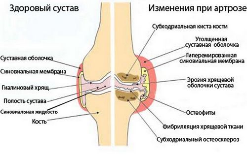 через