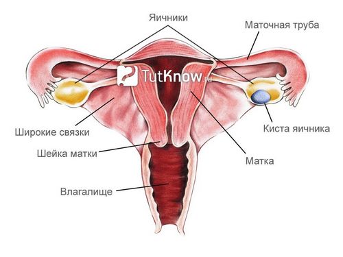 як лікувати функціональну кісту яєчника