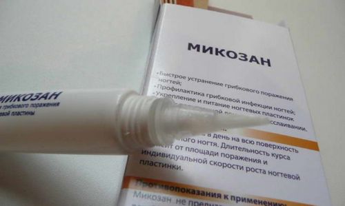 Початкова стадія грибка нігтів на ногах і руках - фото і лікування лікувати нігті ніг