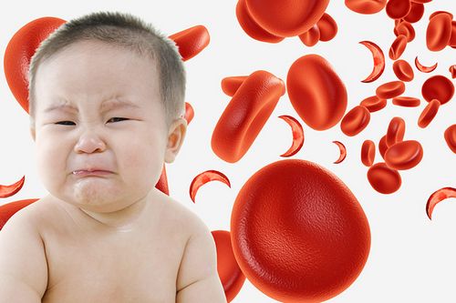 як лікувати анемію у немовляти