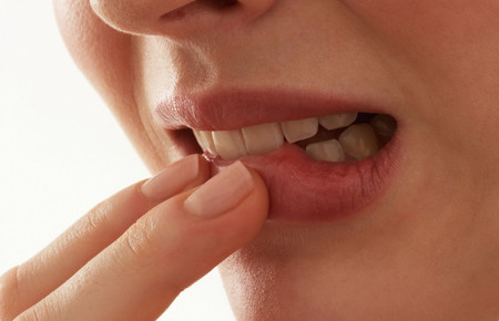 як лікувати папіломи у роті